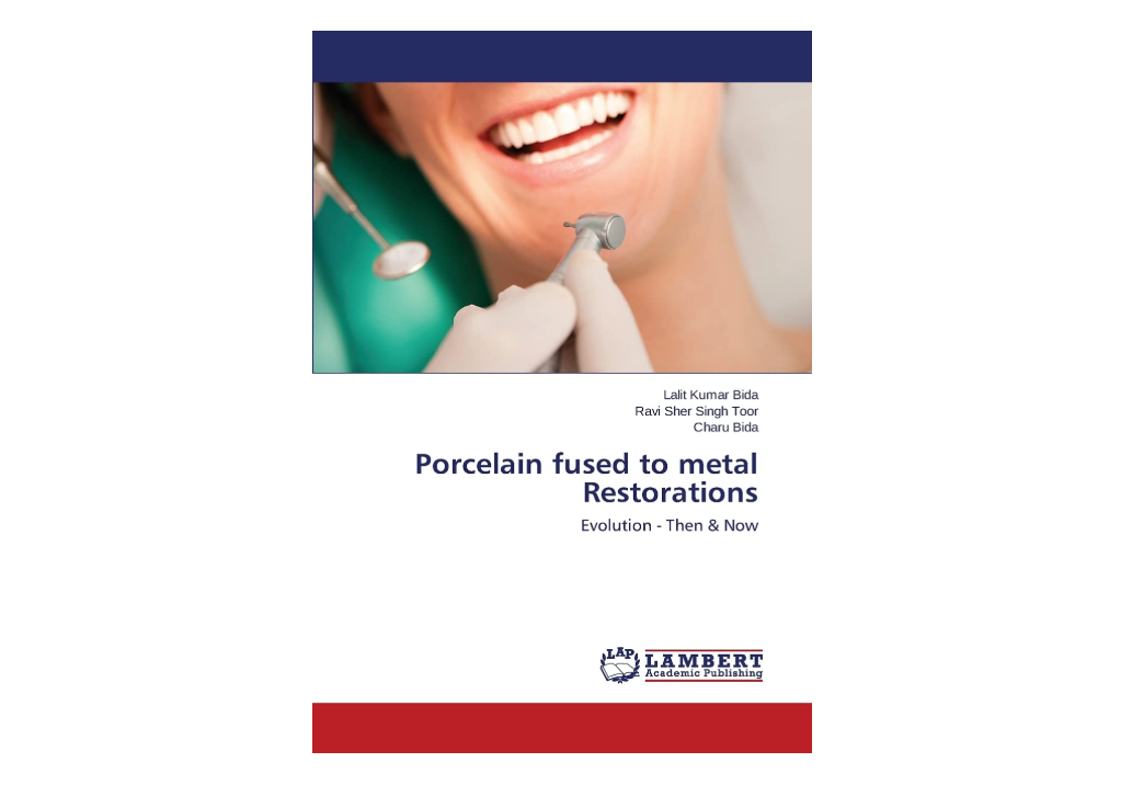 Porcelain fused to metal Restorations: Evolution - Then & Now
