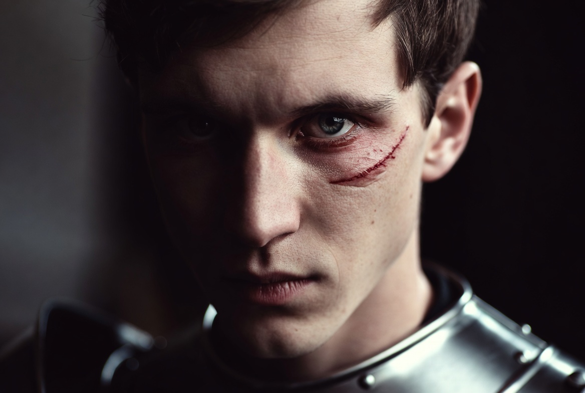King Henry V facial scar from Battle of Shrewsbury
